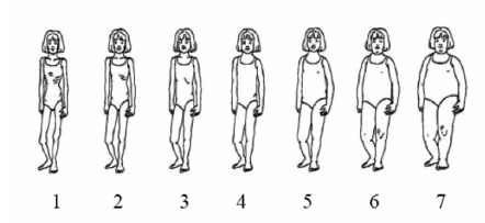 Figure 7 Body image scale, girls